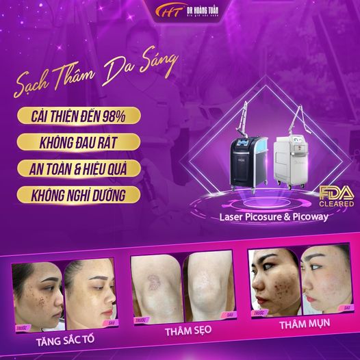 Trị thâm bằng laser